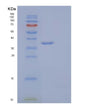 SDS-PAGE analysis of Human IL1R1 (Interleukin-1 Receptor Type 1) - Recombinant Protein, showing >95% purity under 15% SDS-PAGE (Reduced)