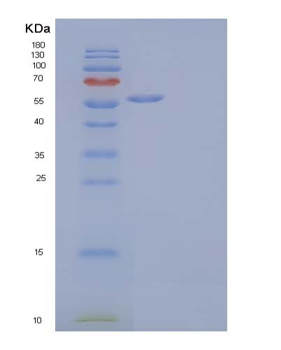 SDS-PAGE analysis of Human MICA (Mhc Class I Polypeptide-Related Sequence A) - Recombinant Protein, showing >85% purity under 15% SDS-PAGE (Reduced)