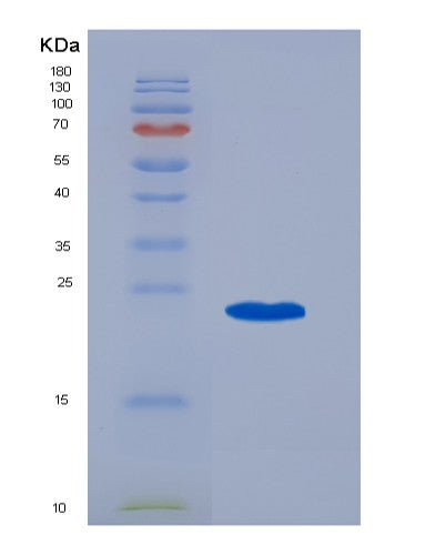 SDS-PAGE analysis of Human MS4A1 (B-Lymphocyte Antigen Cd20) - Recombinant Protein, showing >90% purity under 15% SDS-PAGE (Reduced)