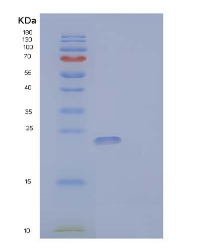 SDS-PAGE analysis of Human CSF3 (Granulocyte Colony-Stimulating Factor) - Recombinant Protein, showing >85% purity under 15% SDS-PAGE (Reduced)