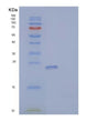 SDS-PAGE analysis of Human CSF3 (Granulocyte Colony-Stimulating Factor) - Recombinant Protein, showing >85% purity under 15% SDS-PAGE (Reduced)