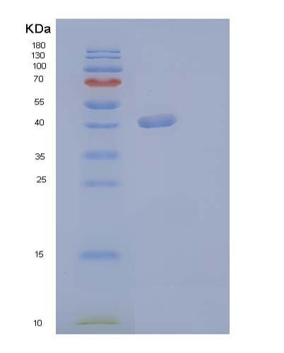 SDS-PAGE analysis of Human CSF3 (Granulocyte Colony-Stimulating Factor) - Recombinant Protein, showing >90% purity under 15% SDS-PAGE (Reduced)