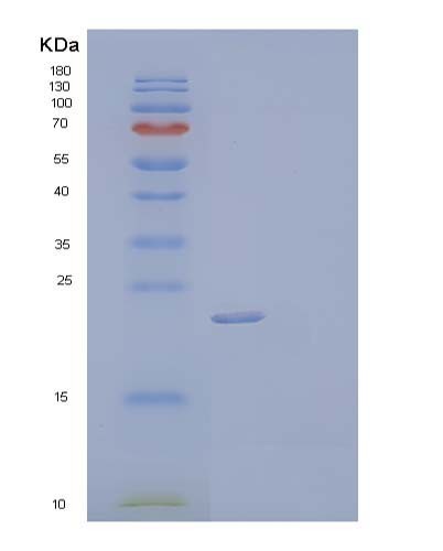 SDS-PAGE analysis of Human TIMP2 (Metalloproteinase Inhibitor 2) - Recombinant Protein, showing >90% purity under 15% SDS-PAGE (Reduced)