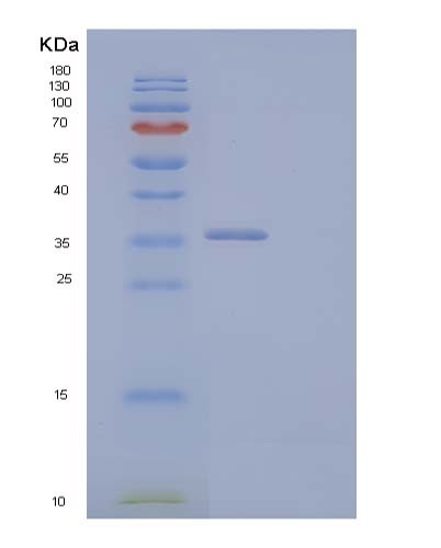 SDS-PAGE analysis of Human CCND2 (G1/S-Specific Cyclin-D2) - Recombinant Protein, showing >90% purity under 15% SDS-PAGE (Reduced)