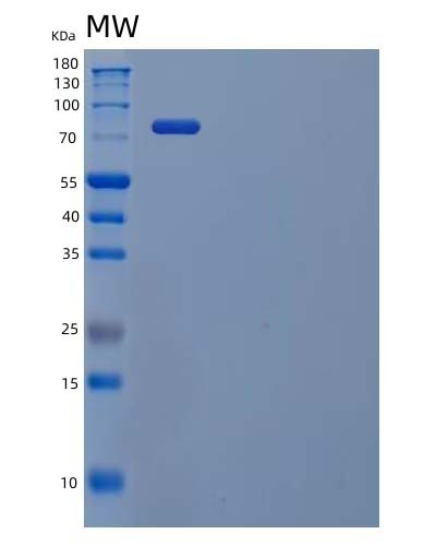 SDS-PAGE analysis of Human STAT1 (Signal Transducer And Activator Of Transcription 1-Alpha/Beta) - Recombinant Protein, showing >85% purity under 15% SDS-PAGE (Reduced)