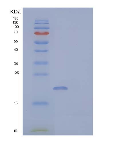 SDS-PAGE analysis of Human UBE2B (Ubiquitin-Conjugating Enzyme E2 B) - Recombinant Protein, showing >95% purity under 15% SDS-PAGE (Reduced)