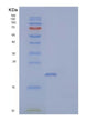 SDS-PAGE analysis of Human UBE2B (Ubiquitin-Conjugating Enzyme E2 B) - Recombinant Protein, showing >95% purity under 15% SDS-PAGE (Reduced)