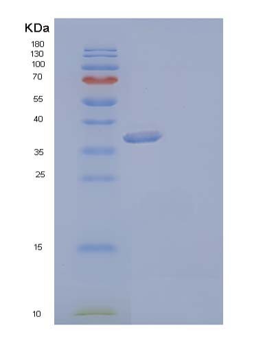 SDS-PAGE analysis of Human AKR1C3 (Aldo-Keto Reductase Family 1 Member C3) - Recombinant Protein, showing >95% purity under 15% SDS-PAGE (Reduced)