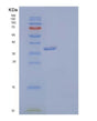 SDS-PAGE analysis of Human AKR1C3 (Aldo-Keto Reductase Family 1 Member C3) - Recombinant Protein, showing >95% purity under 15% SDS-PAGE (Reduced)