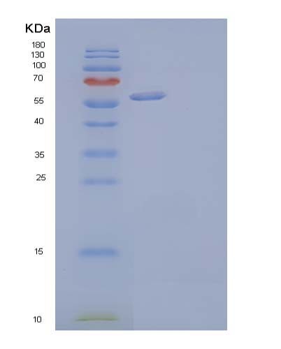SDS-PAGE analysis of Human DKK2 (Dickkopf-Related Protein 2) - Recombinant Protein, showing >95% purity under 15% SDS-PAGE (Reduced)
