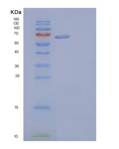 SDS-PAGE analysis of Human AFP (Alpha-Fetoprotein) - Recombinant Protein, showing >90% purity under 15% SDS-PAGE (Reduced)