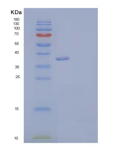 SDS-PAGE analysis of Human ANXA2 (Annexin A2) - Recombinant Protein, showing >85% purity under 15% SDS-PAGE (Reduced)