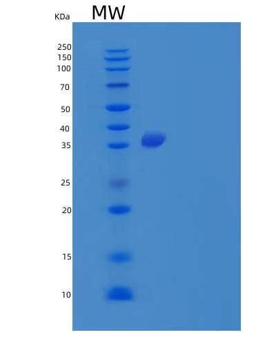 SDS-PAGE analysis of Human ST8SIA1 (Alpha-N-Acetylneuraminide Alpha-2,8-Sialyltransferase) - Recombinant Protein, showing >85% purity under 15% SDS-PAGE (Reduced)