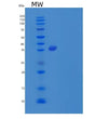 SDS-PAGE analysis of Human ST8SIA1 (Alpha-N-Acetylneuraminide Alpha-2,8-Sialyltransferase) - Recombinant Protein, showing >85% purity under 15% SDS-PAGE (Reduced)
