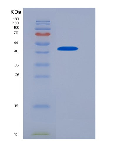 SDS-PAGE analysis of Human FCGR2A (Low Affinity Immunoglobulin Gamma Fc Region Receptor Ii-A) - Recombinant Protein, showing >85% purity under 15% SDS-PAGE (Reduced)