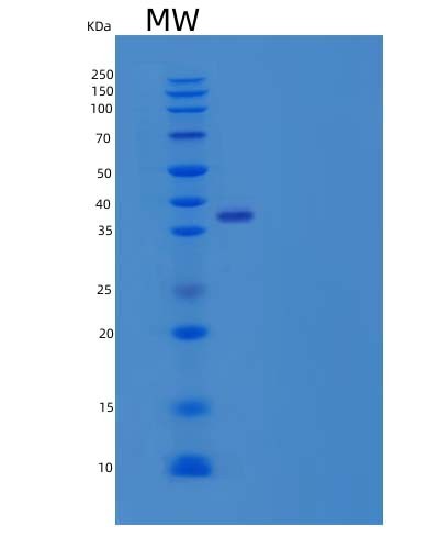 SDS-PAGE analysis of Human SFTPD (Pulmonary Surfactant-Associated Protein D) - Recombinant Protein, CAT# BLT-08412P showing >85% purity under 15% SDS-PAGE (Reduced)