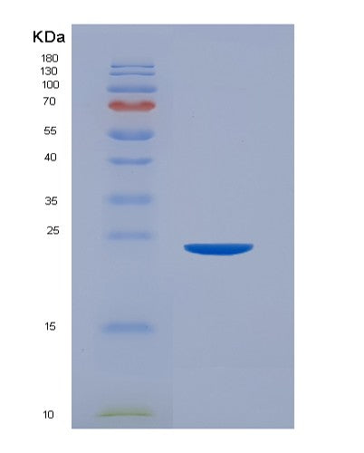 SDS-PAGE analysis of Human FCGR2A (Low Affinity Immunoglobulin Gamma Fc Region Receptor Ii-A) - Recombinant Protein, showing >95% purity under 15% SDS-PAGE (Reduced)