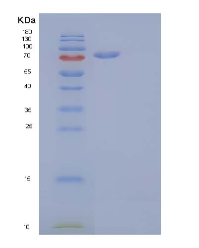 SDS-PAGE analysis of Human CDH16 (Cadherin-16) - Recombinant Protein, showing >90% purity under 15% SDS-PAGE (Reduced)