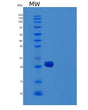 SDS-PAGE analysis of Human VEGFC (Vascular Endothelial Growth Factor C) - Recombinant Protein, showing >95% purity under 15% SDS-PAGE (Reduced)