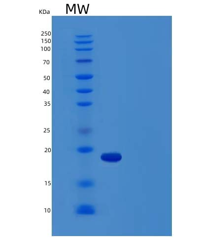 SDS-PAGE analysis of Human LTA (Lymphotoxin-Alpha) - Recombinant Protein, showing >85% purity under 15% SDS-PAGE (Reduced)