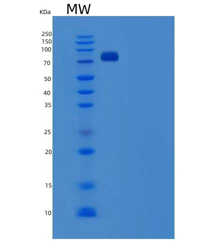 SDS-PAGE analysis of Human SCARB1 (Scavenger Receptor Class B Member 1) - Recombinant Protein, showing >85% purity under 15% SDS-PAGE (Reduced)