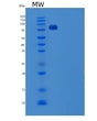 SDS-PAGE analysis of Human SCARB1 (Scavenger Receptor Class B Member 1) - Recombinant Protein, showing >85% purity under 15% SDS-PAGE (Reduced)