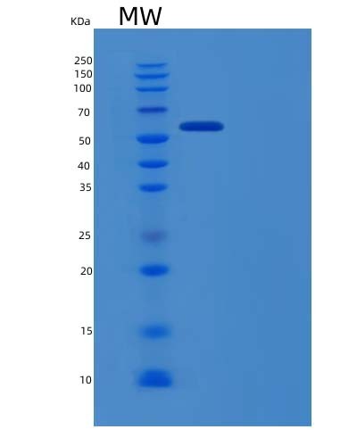 SDS-PAGE analysis of Human EPHB6 (Ephrin Type-B Receptor 6) - Recombinant Protein, showing >90% purity under 15% SDS-PAGE (Reduced)