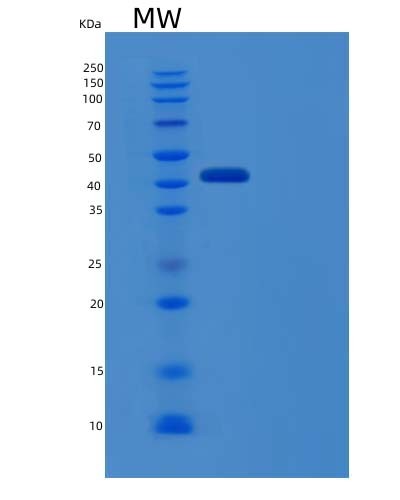 SDS-PAGE analysis of Human IFNAR1 (Interferon Alpha/Beta Receptor 1) - Recombinant Protein, showing >85% purity under 15% SDS-PAGE (Reduced)