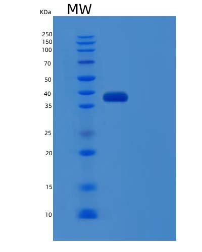 SDS-PAGE analysis of Human CFHR1 (Complement Factor H-Related Protein 1) - Recombinant Protein, showing >95% purity under 15% SDS-PAGE (Reduced)