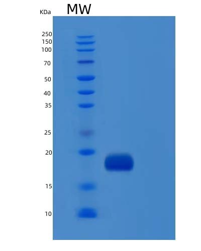SDS-PAGE analysis of Human IL1F10 (Interleukin-1 Family Member 10) - Recombinant Protein, showing >90% purity under 15% SDS-PAGE (Reduced)