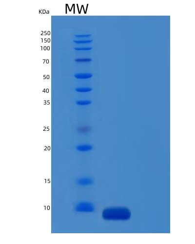 SDS-PAGE analysis of Mouse C5 (Complement C5) - Recombinant Protein, showing >95% purity under 15% SDS-PAGE (Reduced)