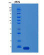 SDS-PAGE analysis of Mouse C5 (Complement C5) - Recombinant Protein, showing >95% purity under 15% SDS-PAGE (Reduced)