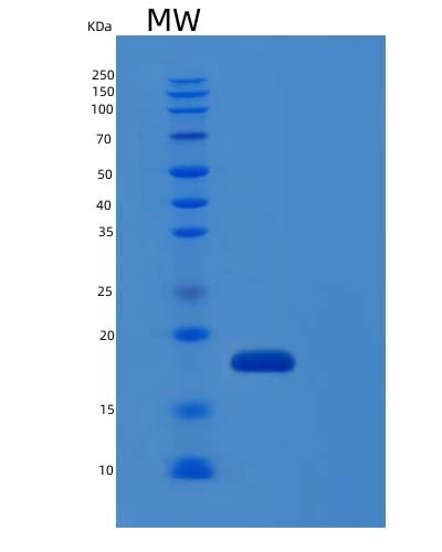 SDS-PAGE analysis of Human IL1RN (Interleukin-1 Receptor Antagonist Protein) - Recombinant Protein, showing >85% purity under 15% SDS-PAGE (Reduced)