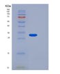 SDS-PAGE analysis of Human FGF14 (Fibroblast Growth Factor 14) - Recombinant Protein, showing >95% purity under 15% SDS-PAGE (Reduced)