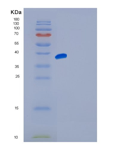 SDS-PAGE analysis of Human FGFR4 (Fibroblast Growth Factor Receptor 4) - Recombinant Protein, showing >90% purity under 15% SDS-PAGE (Reduced)