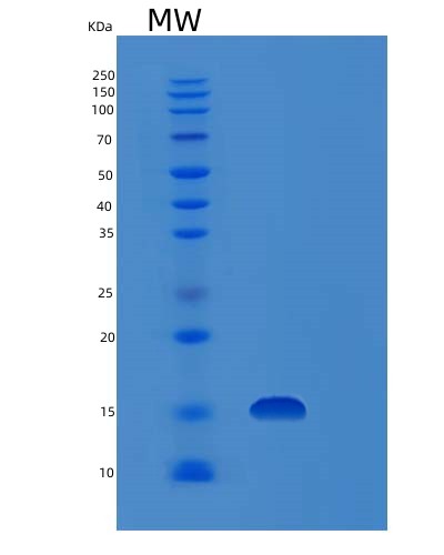 SDS-PAGE analysis of Human FHIT (Bis(5'-Adenosyl)-Triphosphatase) - Recombinant Protein, showing >85% purity under 15% SDS-PAGE (Reduced)