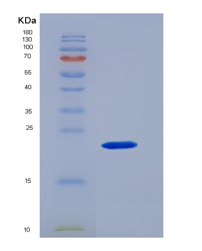 SDS-PAGE analysis of Human IL10 (Interleukin-10) - Recombinant Protein, showing >95% purity under 15% SDS-PAGE (Reduced)