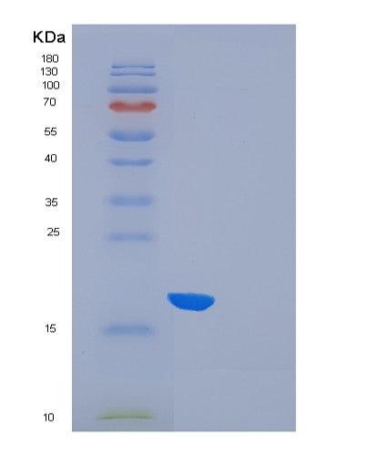 SDS-PAGE analysis of Human FLT3LG (Fms-Related Tyrosine Kinase 3 Ligand) - Recombinant Protein, showing >90% purity under 15% SDS-PAGE (Reduced)