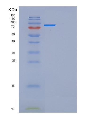 SDS-PAGE analysis of Mouse Folh1 (Glutamate Carboxypeptidase 2) - Recombinant Protein, showing >90% purity under 15% SDS-PAGE (Reduced)