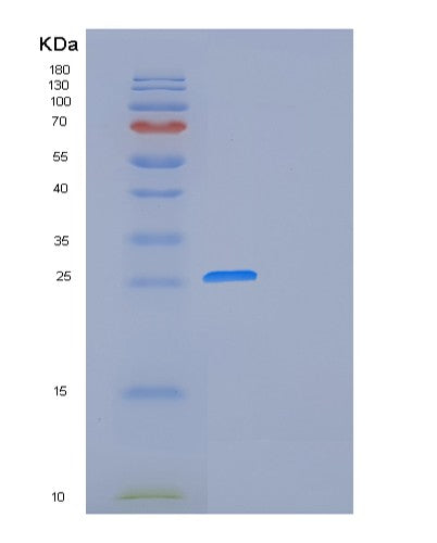 SDS-PAGE analysis of Human FOLR1 (Folate Receptor Alpha) - Recombinant Protein, showing >90% purity under 15% SDS-PAGE (Reduced)