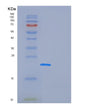 SDS-PAGE analysis of Human CEP20 (Centrosomal Protein 20) - Recombinant Protein, showing >90% purity under 15% SDS-PAGE (Reduced)