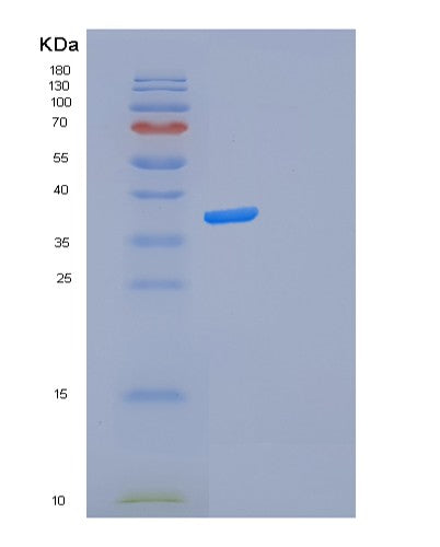 SDS-PAGE analysis of Human FOSL2 (Fos-Related Antigen 2) - Recombinant Protein, showing >85% purity under 15% SDS-PAGE (Reduced)