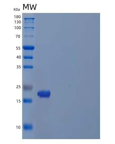 SDS-PAGE analysis of Human PDAP1 (28 Kda Heat- And Acid-Stable Phosphoprotein) - Recombinant Protein, showing >90% purity under 15% SDS-PAGE (Reduced)
