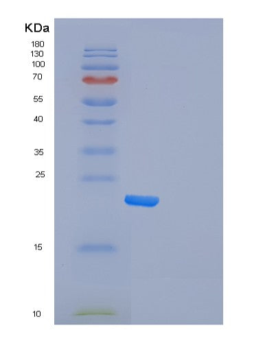 SDS-PAGE analysis of Human FXN (Frataxin, Mitochondrial) - Recombinant Protein, showing >95% purity under 15% SDS-PAGE (Reduced)