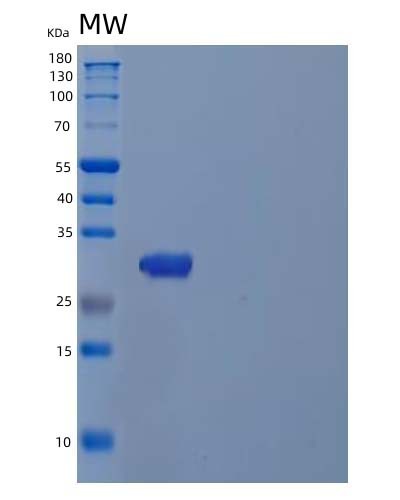 SDS-PAGE analysis of Human TPSAB1 (Tryptase Alpha/Beta-1) - Recombinant Protein, showing >85% purity under 15% SDS-PAGE (Reduced)