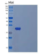 SDS-PAGE analysis of Human TPSAB1 (Tryptase Alpha/Beta-1) - Recombinant Protein, showing >85% purity under 15% SDS-PAGE (Reduced)