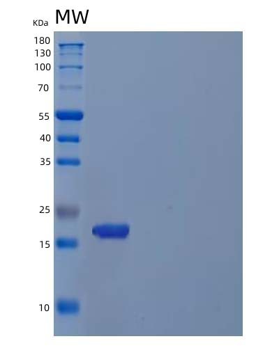 SDS-PAGE analysis of Human CDKN2C (Cyclin-Dependent Kinase 4 Inhibitor C) - Recombinant Protein, showing >95% purity under 15% SDS-PAGE (Reduced)