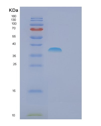 SDS-PAGE analysis of Human FSBP (Fibrinogen Silencer-Binding Protein) - Recombinant Protein, showing >95% purity under 15% SDS-PAGE (Reduced)
