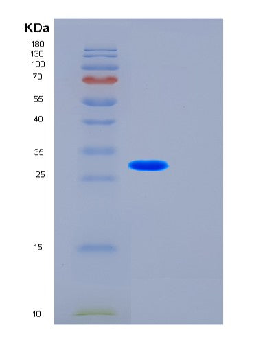 SDS-PAGE analysis of Human FST (Follistatin) - Recombinant Protein, showing >85% purity under 15% SDS-PAGE (Reduced)