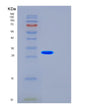 SDS-PAGE analysis of Human FST (Follistatin) - Recombinant Protein, showing >85% purity under 15% SDS-PAGE (Reduced)